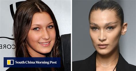 bella hadid buccal fat removal|Why The Rising Popularity of Buccal Fat Removal Is。